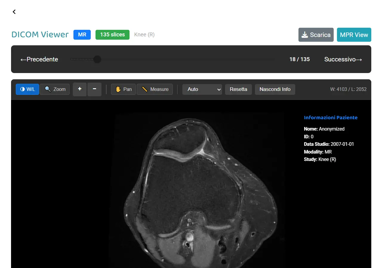 Visualizzatore DICOM che mostra una risonanza al ginocchio in Ippocra