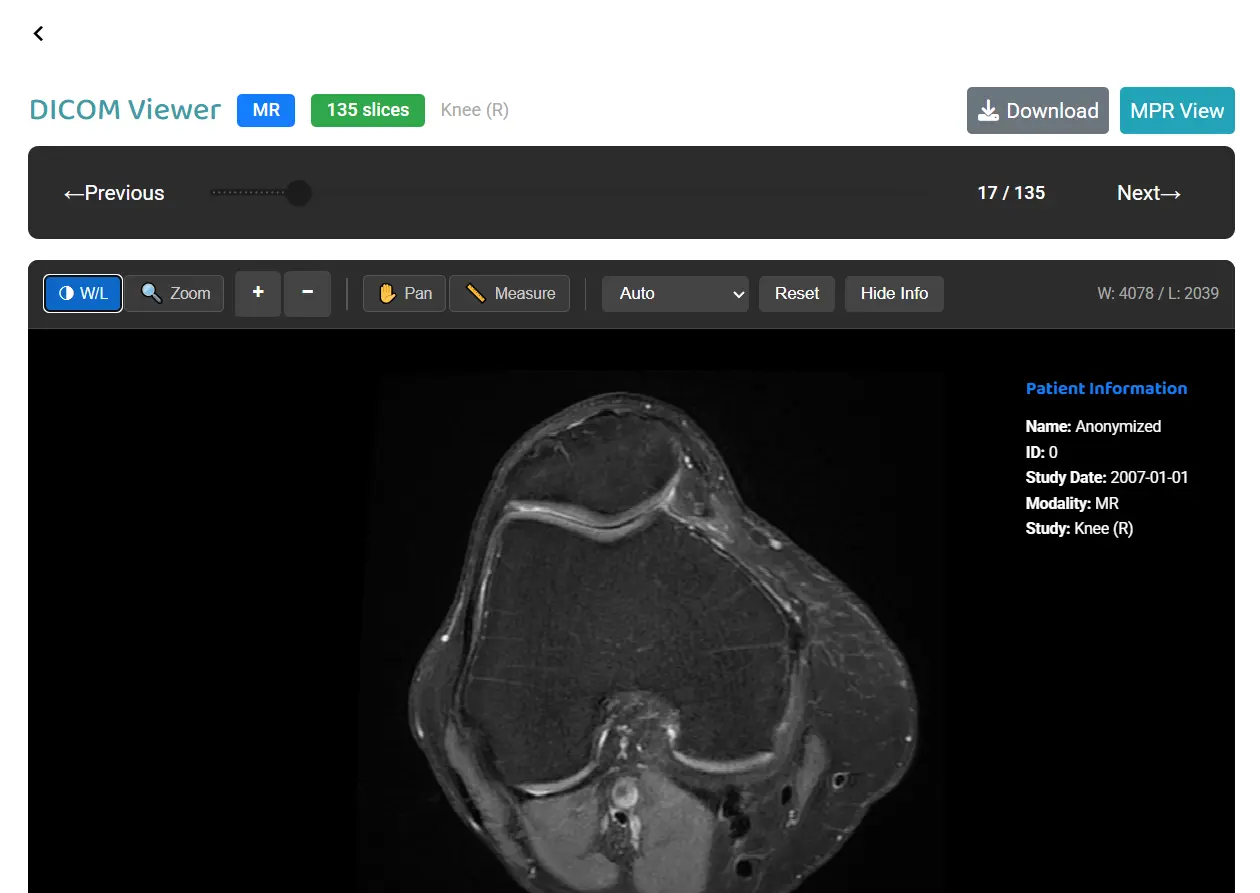 DICOM viewer showing a knee MRI scan in Ippocra